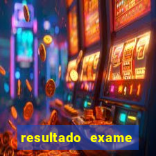 resultado exame eliel figueiredo