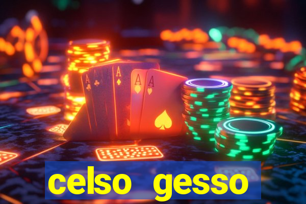 celso gesso cruzeiro sp